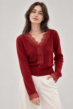 Women's Cardigan | Lace-Look Trim & Button Front